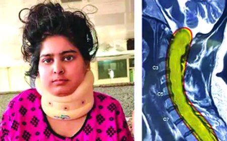 ऑपरेशन  से सबसे बड़ा ट्यूमर निकाला