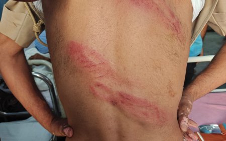 वन विभाग के गश्ती दल पर खनन माफियाओं ने किया हमला