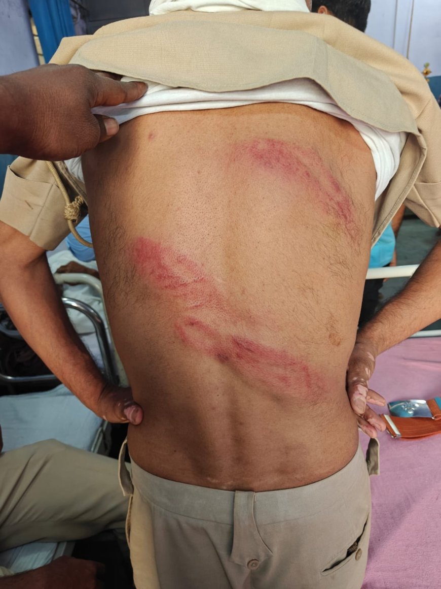 वन विभाग के गश्ती दल पर खनन माफियाओं ने किया हमला